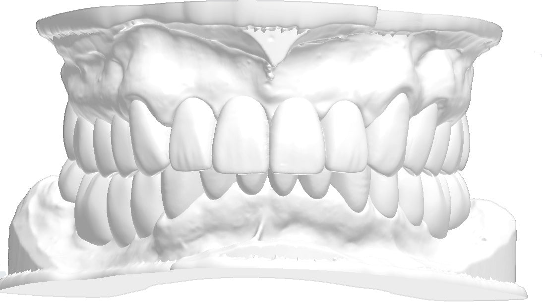 KNK Dental Solution®