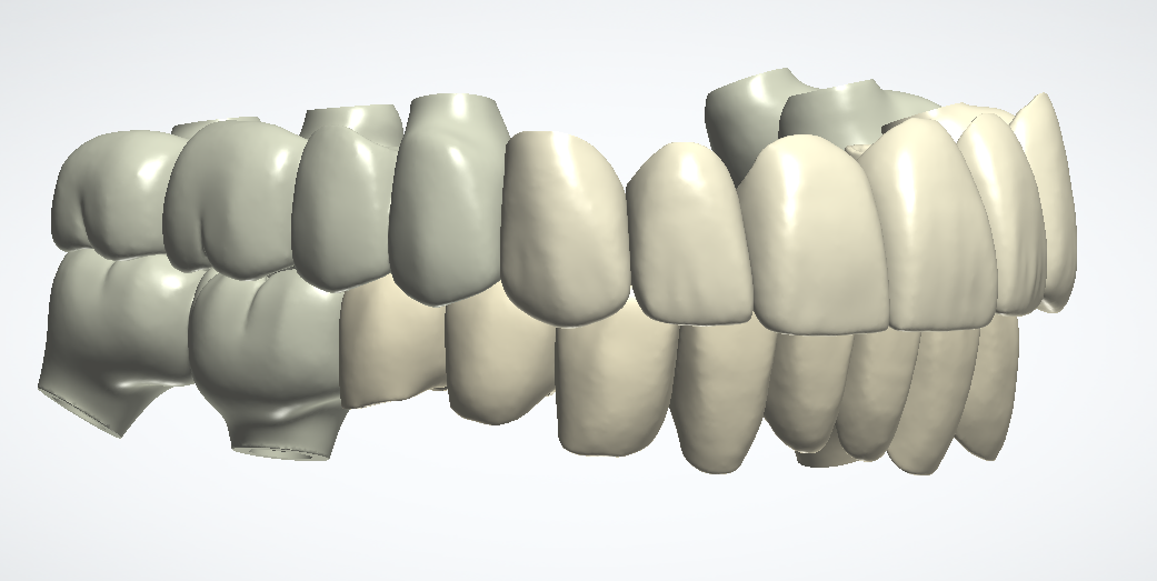 KNK Dental Solution®