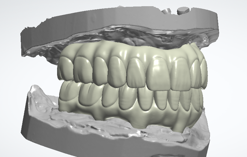 KNK Dental Solution®